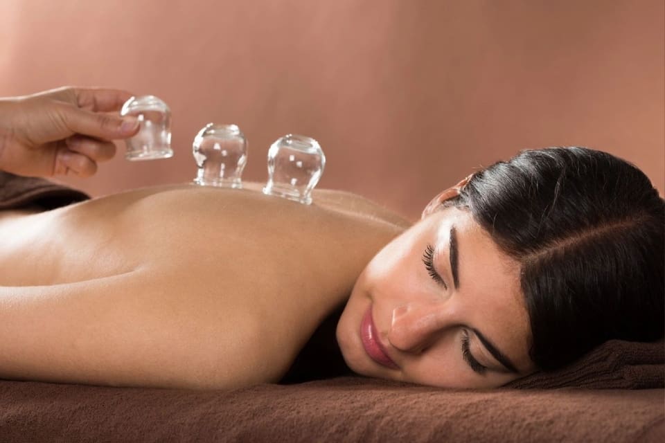 A woman is getting an acupuncture treatment.